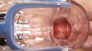 PervCity Profondità Dentro Mamme Stronzo. Date un'occhiata All'interno Julia Anns troia stronzo quando Mike Adriano si diffonde il suo aperto con uno speculum e poi scopa che MILFs stronzo